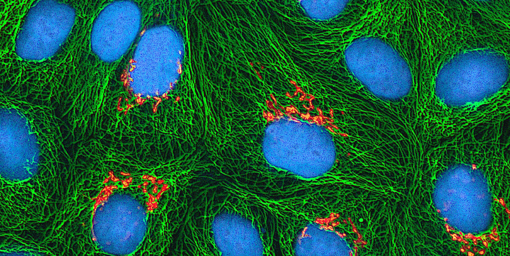 green fluorescent protein